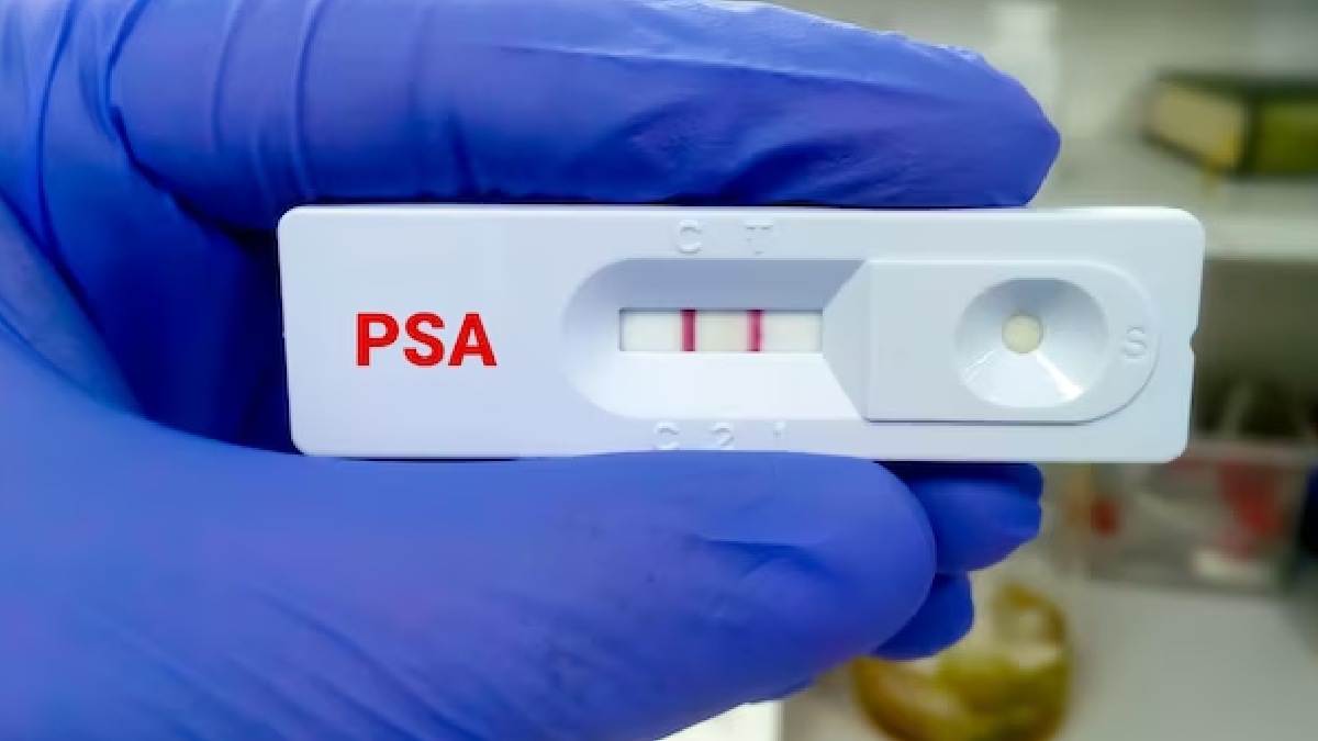 when-is-the-right-time-to-get-a-psa-test-for-prostate-cancer